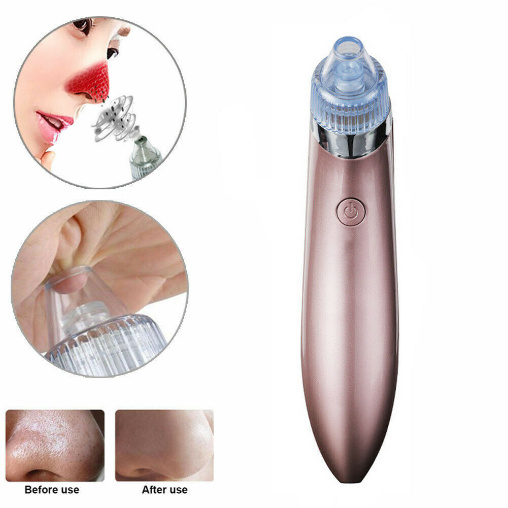 Electric Blackhead Vacuum Pore Cleaner SELFLOVECLUB