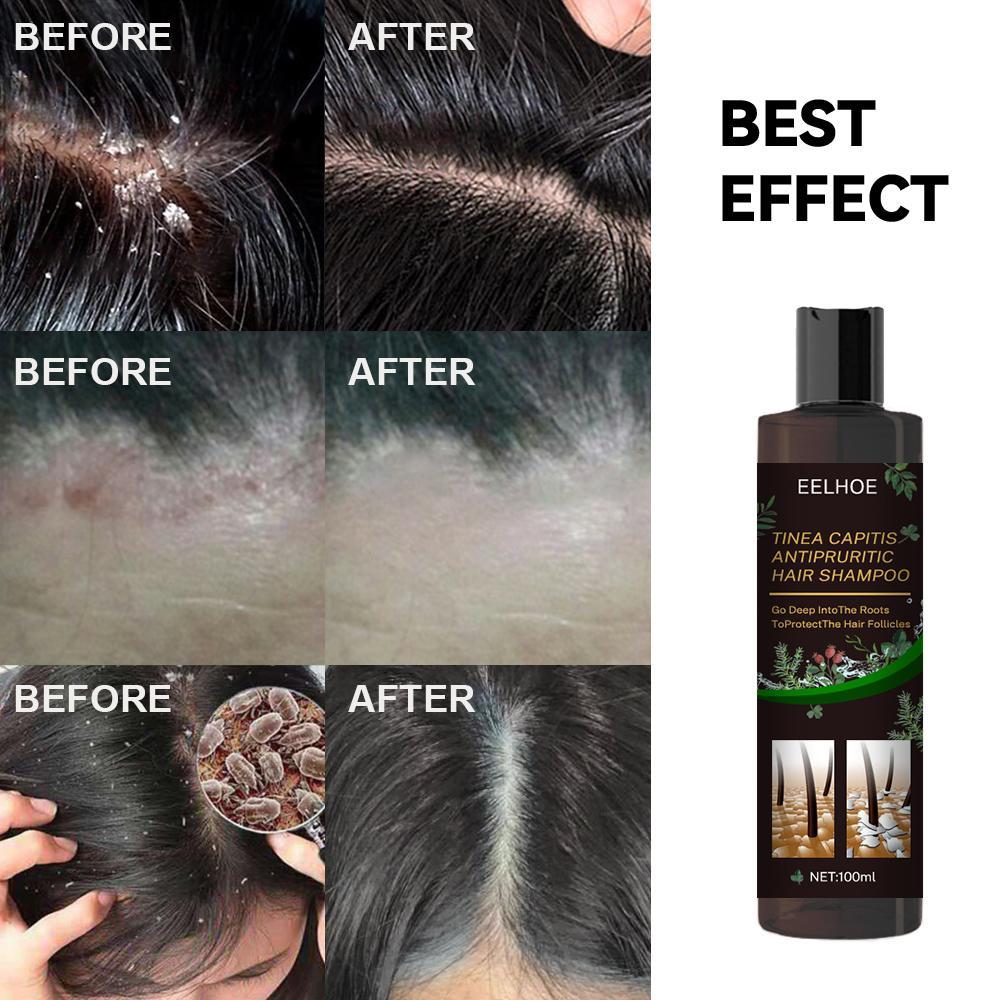 EELHOE Anti-Dandruff Shampoo SELFLOVECLUB