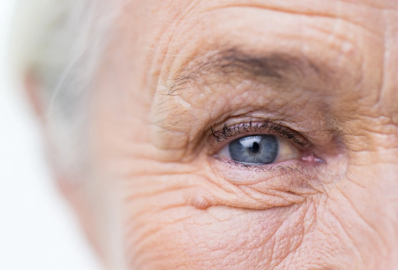 Prevent-Accelerated-Aging-The-Key-to-Aging-Gracefully selfloveclub