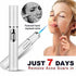 Blue Light Therapy Acne Laser Pen Soft Scar Wrinkle Removal Treatment Device Skin Care Beauty Equipment SELFLOVECLUB