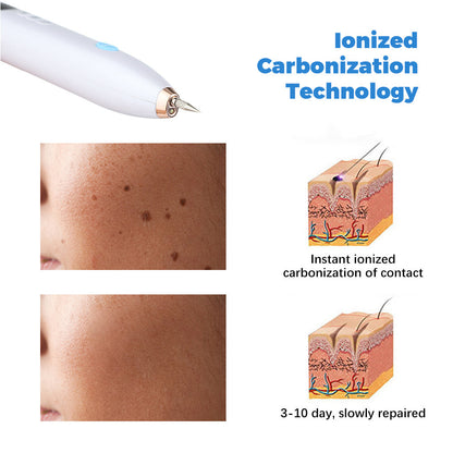 Laser Skin Tag Remover SELFLOVECLUB