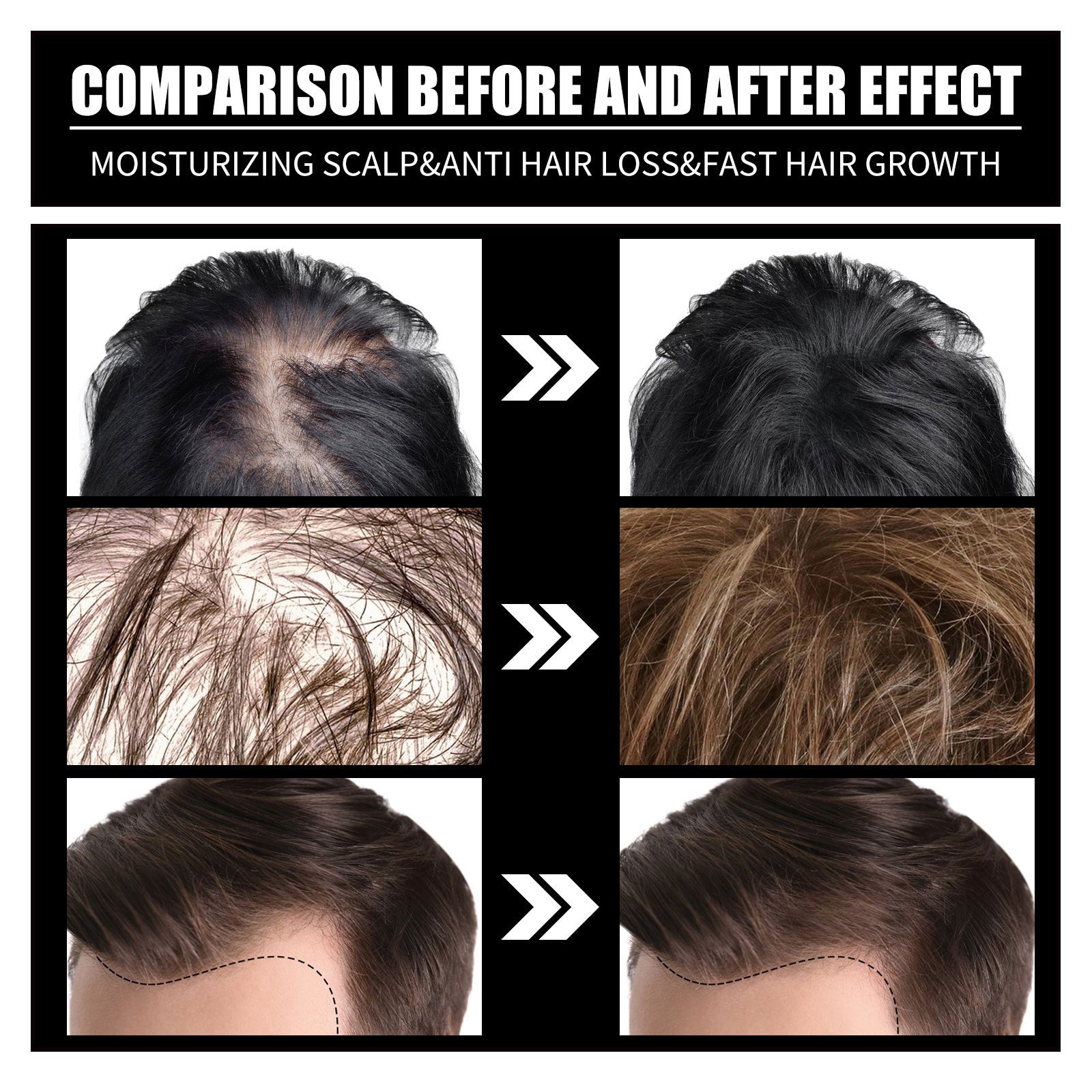 Biotin And Liquid Collagen Supplement SELFLOVECLUB