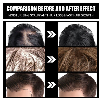 Biotin And Liquid Collagen Supplement SELFLOVECLUB