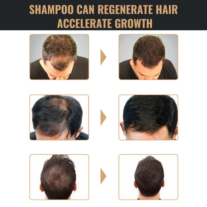 Root Activator Shampoo SELFLOVECLUB