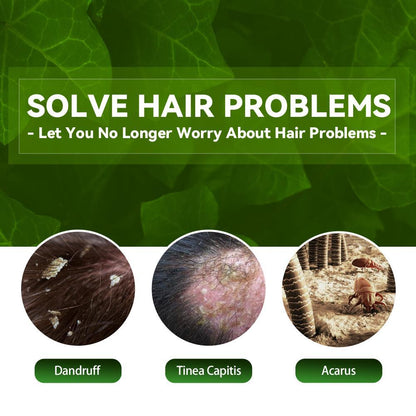 EELHOE Anti-Dandruff Shampoo SELFLOVECLUB