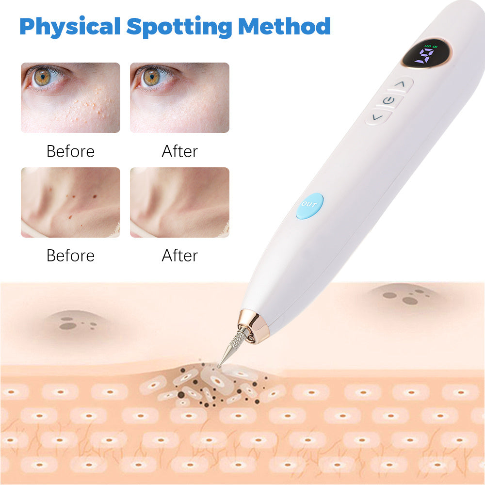 Laser Skin Tag Remover SELFLOVECLUB